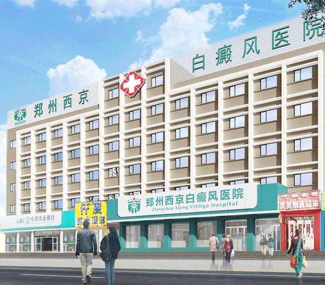 郑州西京白癜风医院