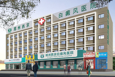 郑州西京白癜风医院